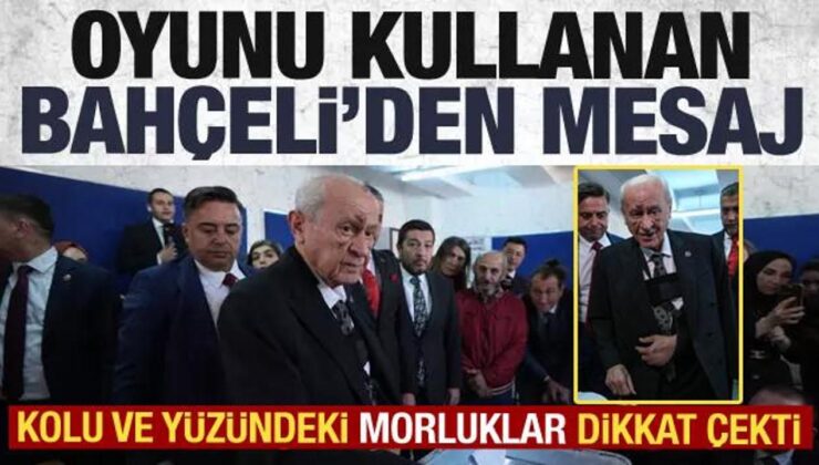 Bahçeli oyunu kullandı! Yüzündeki morlukların nedeni belli oldu