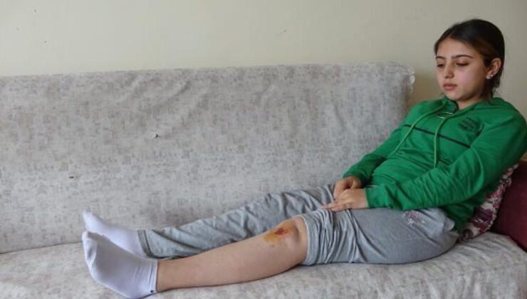 Liseli Özge, köpeklerin saldırısında yaralandı