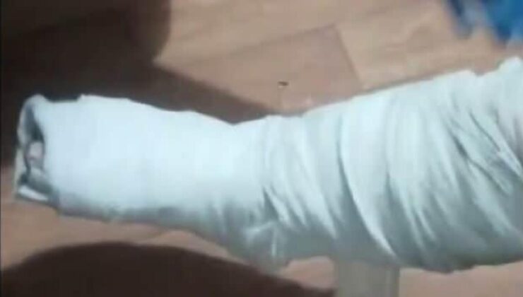 Yolcunun ayağına sarılı alçından eroin çıktı