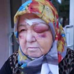 Başıboş köpek dehşeti devam ediyor! Yaşlı kadın tanınmaz hale geldi...