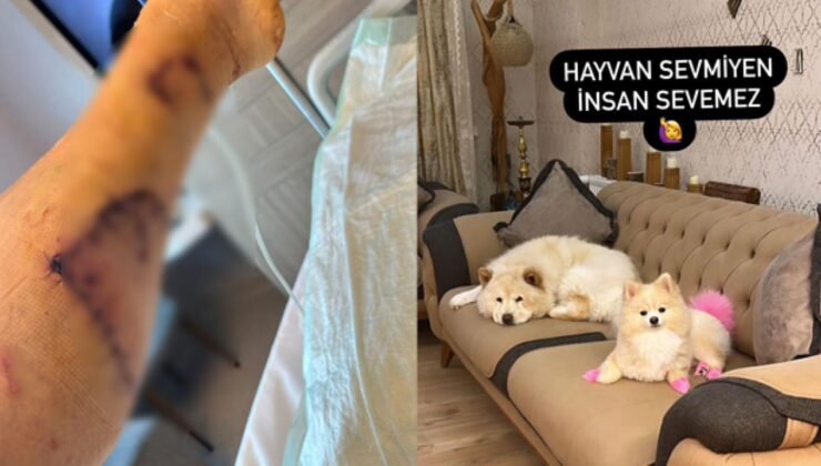 Evdeki diğer köpekten sahibini kıskanarak bacağını parçaladı