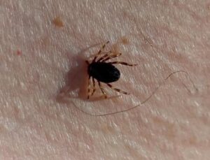 Türkiye genelinde vakalar arttı! Uzmanlar uyardı