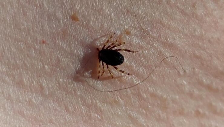 Türkiye genelinde vakalar arttı! Uzmanlar uyardı