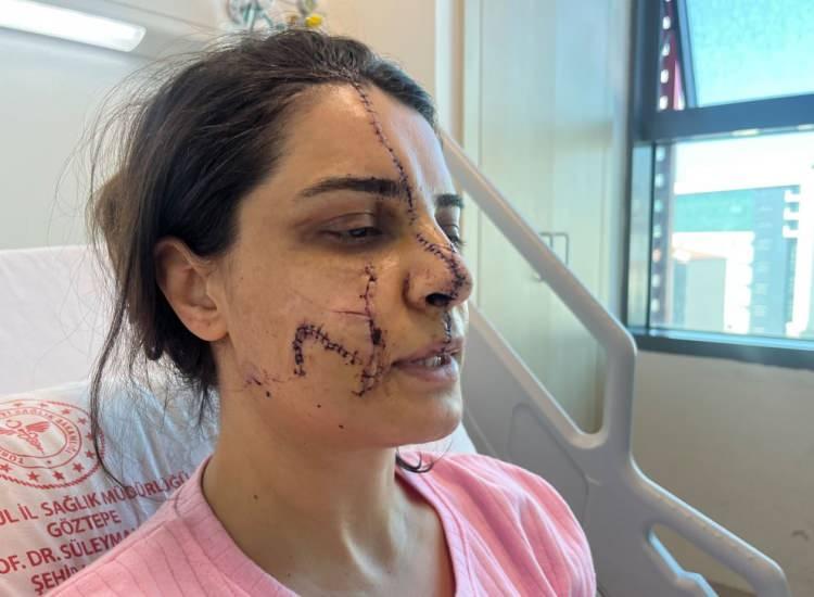 <p>Marmaray’da 2 yıl boyunca tehdit ve taciz edildiği kişinin bıçaklı saldırısına uğrayan Gülhan Karadereli, yaşadığı dehşet dolu anları yüzündeki 40 dikişle anlattı… </p><p> </p>