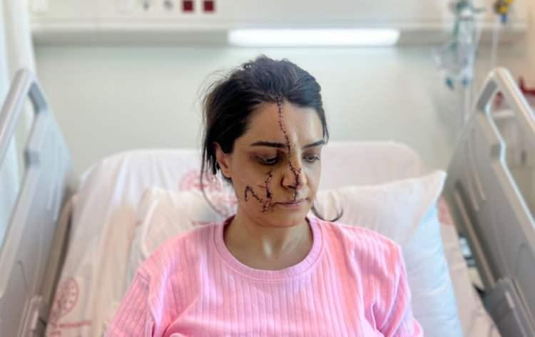 <p>Olay, 15 Mart'ta Kadıköy'de, Göztepe Marmaray İstasyonu'nda meydana geldi. 36 yaşındaki temizlik görevlisi Çetin Akay, 2 senedir aynı bölgede çalıştığı istasyonun güvenlik görevlisi Gülhan Karadereli'yi taciz ediyordu. </p><p> </p>