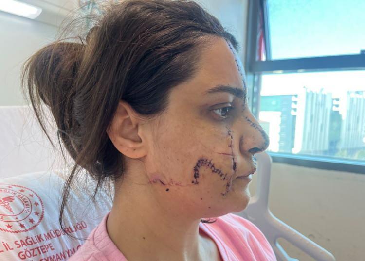 <p>Karadereli, 8 Mart Dünya Kadınlar gününde de Akay tarafından tehdit edildiğini belirterek, <strong>“Güçlü ve dirayetli olmamız gerek. Bizler değerliyiz, inşallah hiçbir kadın benim durumuma düşmez. Benim durumuma düşerseler bile lütfen suç duyurusunda bulunsunlar, saklamasınlar. 8 Mart Dünya Kadınlar Günü'nde farklı bir numaradan beri arayarak, 'Beni işimden edersen, seni öldürürüm, keserim' dedi. Bu tehdidi de 8 Mart Dünya Kadınlar Günü'nde yaptı" </strong>dedi.</p><p> </p>