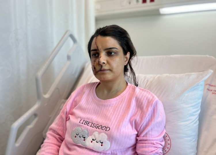 <p>Karadereli, Akay tarafından rahatsız edildiği için defalarca karakola başvurdu. Son olarak 8 Mart'ta kendisini farklı bir telefon numarasından arayan Akay, kendisine bıçakla saldıracağını söyledi. </p><p> </p>