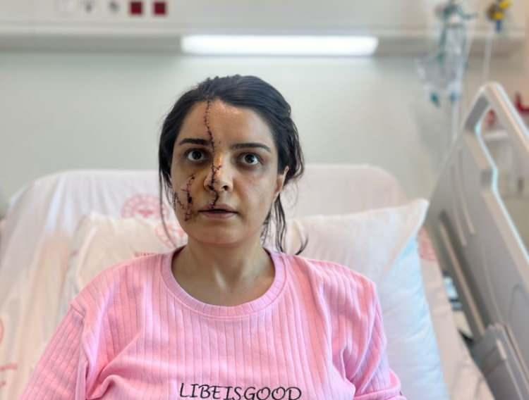 <p>Önce yolcuların arkasında saklanarak bekledi, daha sonra yanında bulunan bıçağıyla Karadereli'ye saldırmaya başladı. </p><p> </p>