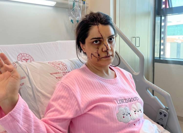 <p>Yüzünden aldığı bıçak darbesiyle Karadereli kanlar içerisinde yere yığıldı. İhbar üzerine olay yerine sağlık ve polis ekipleri sevk edildi. </p><p> </p>