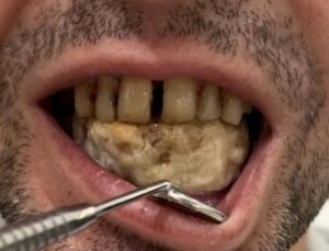 Diş kliniğine giden adam, doktoru şoka uğrattı: ‘Hastamızın yeni icadı’