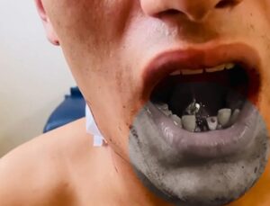 Yolda yürürken silahlı saldırıya uğradı! Boynundan giren mermi çenesine saplandı